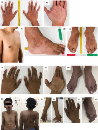 Hand with long, slender, tapering fingers